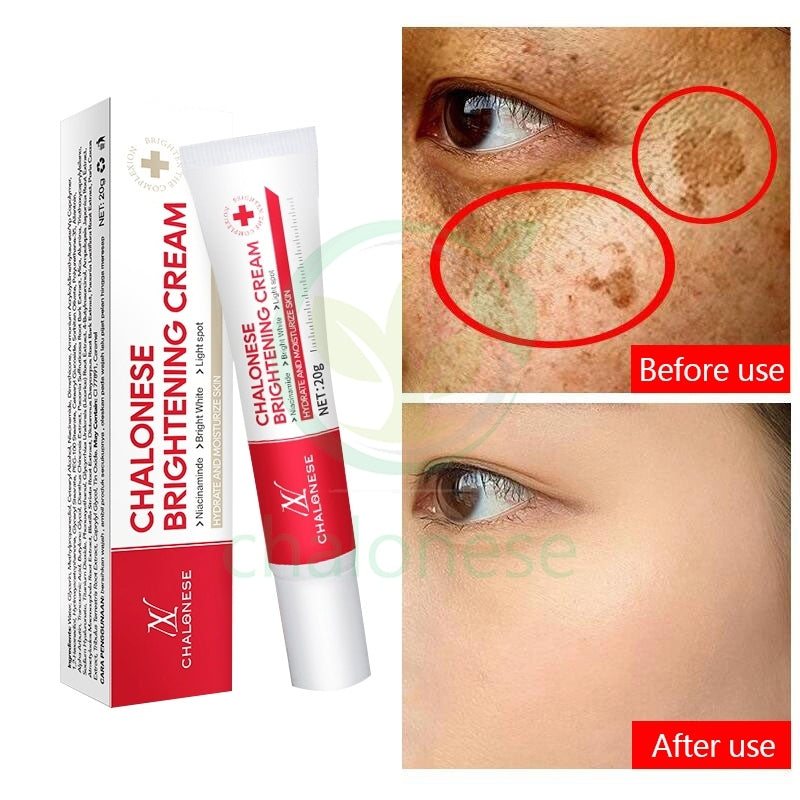 CHALONESE Brightening Cream گر 7 دن میں نتائج نہ ملیں تو مکمل رقم واپس