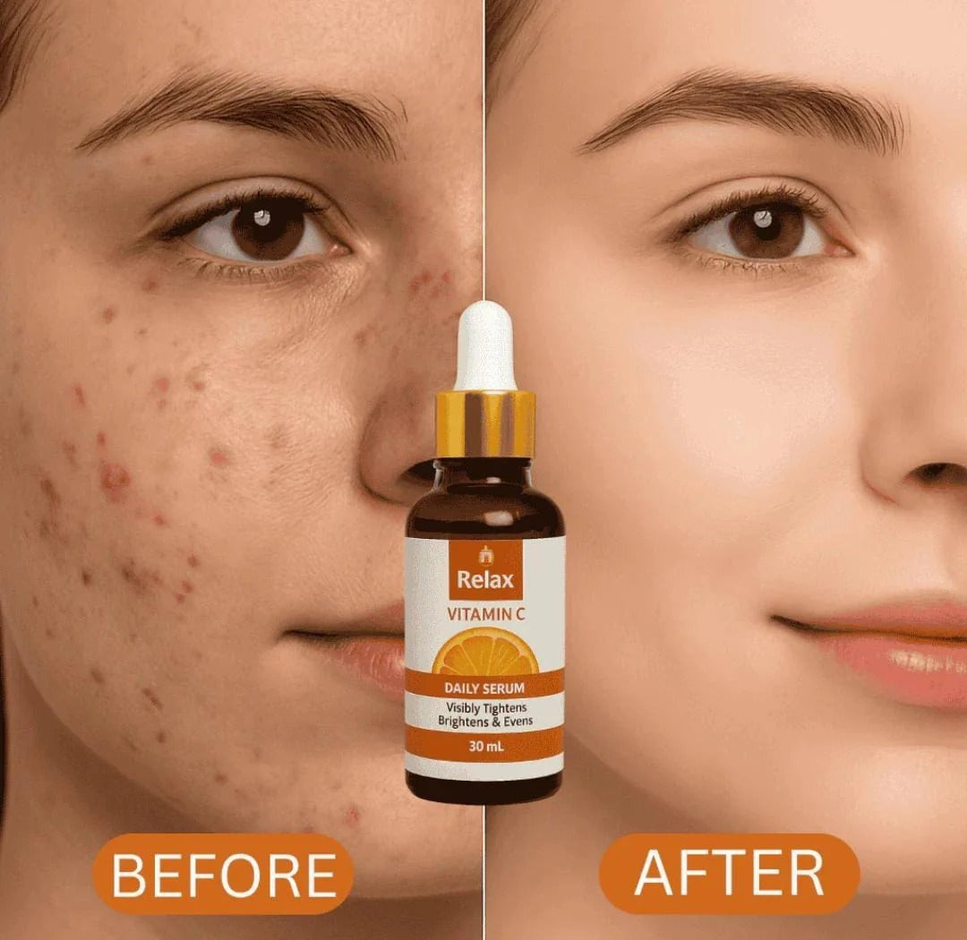 Buy 1 Get 1 Free Relax Vitamin C Serum اگر 7 دن میں نتائج نہ ملیں تو مکمل رقم واپس